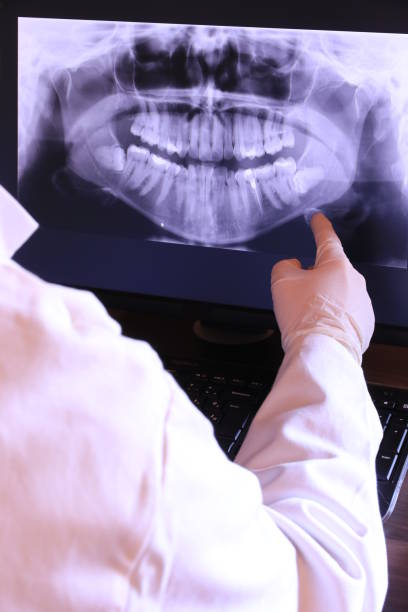 Best Emergency Root Canal Treatment in Harvey, LA